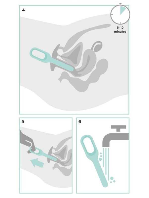 Health Silicone Dilator Set - 图片 7
